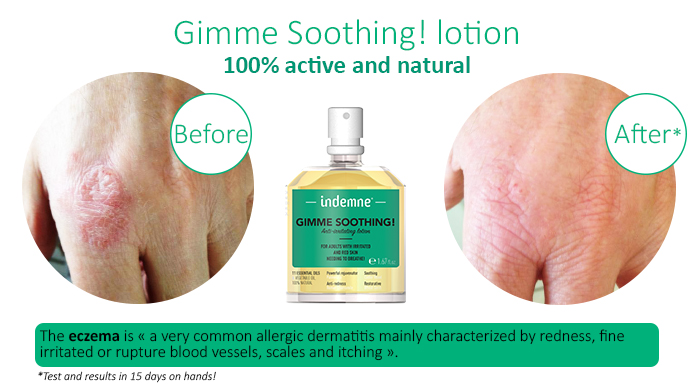 natural lotion with essential oils for sensitives skins